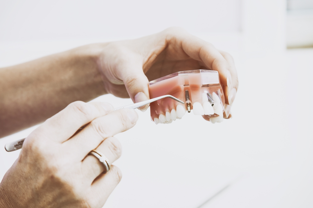 Denture Repairs